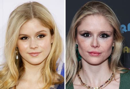 erin moriarty before surgery|Erin Moriarty Plastic Surgery: Anatomy of a Change in Hollywood